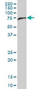 NAE1 Antibody in Western Blot (WB)