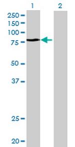 TAX1BP1 Antibody in Western Blot (WB)