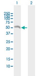 EIF2B3 Antibody in Western Blot (WB)