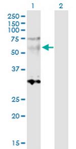 SGCE Antibody in Western Blot (WB)