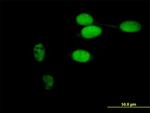 TIMELESS Antibody in Immunocytochemistry (ICC/IF)