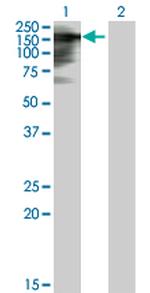 TIMELESS Antibody in Western Blot (WB)