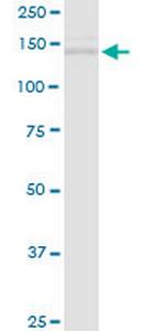 TIMELESS Antibody in Western Blot (WB)