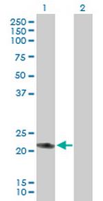 RAB7L1 Antibody in Western Blot (WB)