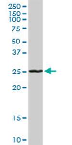 RAB7L1 Antibody in Western Blot (WB)