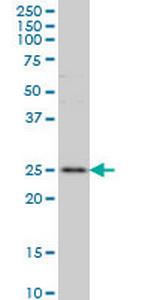 RAB7L1 Antibody in Western Blot (WB)