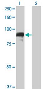 TOP3B Antibody in Western Blot (WB)