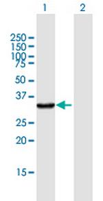 KYNU Antibody in Western Blot (WB)