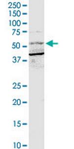 BTRC Antibody in Western Blot (WB)