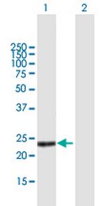 PGLYRP1 Antibody in Western Blot (WB)