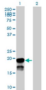 BRSK2 Antibody in Western Blot (WB)