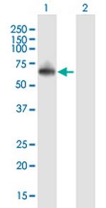 RNF8 Antibody in Western Blot (WB)