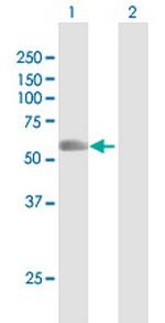 RNF8 Antibody in Western Blot (WB)