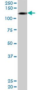 HIP1R Antibody in Western Blot (WB)