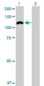 HIP1R Antibody in Western Blot (WB)