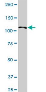 HIP1R Antibody in Western Blot (WB)