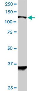 HIP1R Antibody in Western Blot (WB)