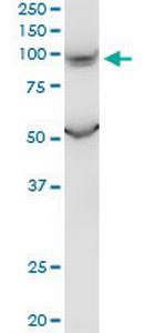 PKD2L1 Antibody in Western Blot (WB)