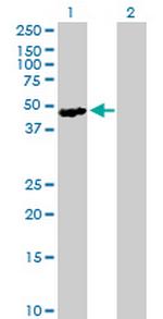 SH2D2A Antibody in Western Blot (WB)