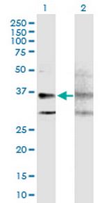 GPRC5A Antibody in Western Blot (WB)