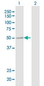 SLC7A7 Antibody in Western Blot (WB)