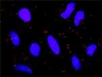 PIAS2 Antibody in Proximity Ligation Assay (PLA) (PLA)