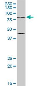 PIAS2 Antibody in Western Blot (WB)