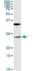 CLDN1 Antibody in Immunoprecipitation (IP)