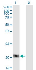 CLDN1 Antibody in Western Blot (WB)