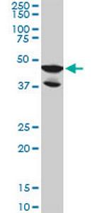 LDB2 Antibody in Western Blot (WB)