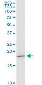 EIF1AY Antibody in Western Blot (WB)