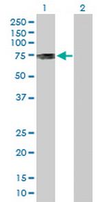 PKMYT1 Antibody in Western Blot (WB)