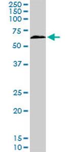 TBX18 Antibody in Western Blot (WB)