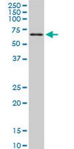 TBX18 Antibody in Western Blot (WB)