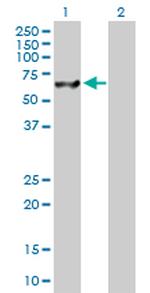 USP14 Antibody in Western Blot (WB)