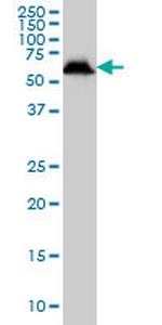 USP14 Antibody in Western Blot (WB)