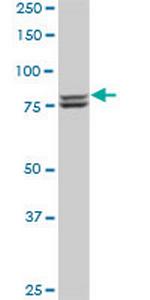 MTA1 Antibody in Western Blot (WB)