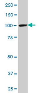 MTA1 Antibody in Western Blot (WB)