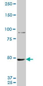 MTA1 Antibody in Western Blot (WB)