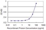 LATS1 Antibody in ELISA (ELISA)