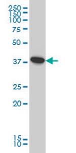 ATP6V0D1 Antibody in Western Blot (WB)