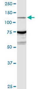 ARHGEF1 Antibody in Western Blot (WB)