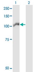 ARHGEF1 Antibody in Western Blot (WB)