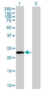 ATG12 Antibody in Western Blot (WB)