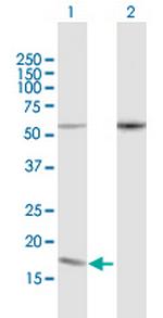 PDCD5 Antibody in Western Blot (WB)