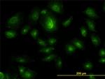 HGS Antibody in Immunocytochemistry (ICC/IF)