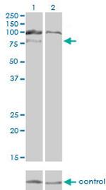 HGS Antibody in Western Blot (WB)