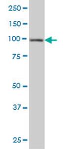 HGS Antibody in Western Blot (WB)