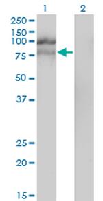 HGS Antibody in Western Blot (WB)