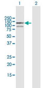 EXO1 Antibody in Western Blot (WB)